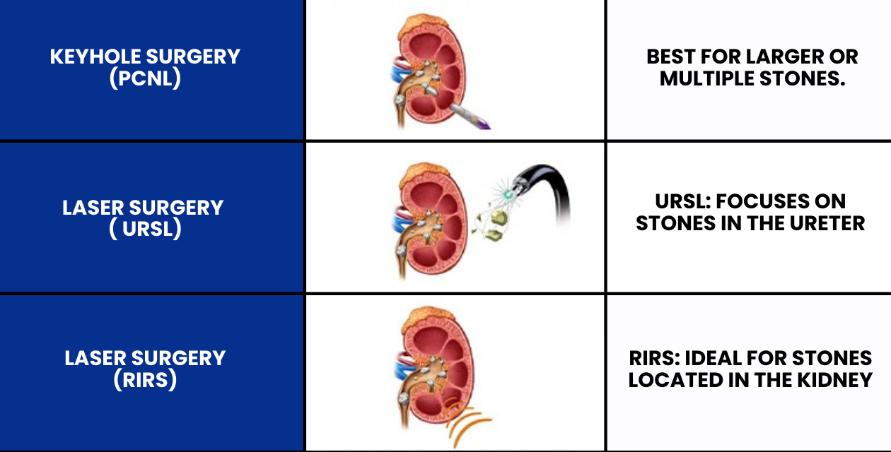 Kidney Stones Treatment Options